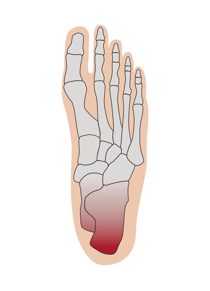Hielontlastingskussen 