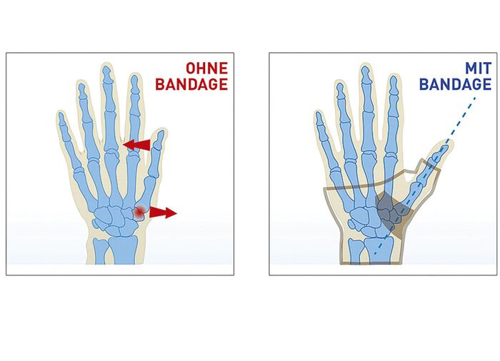 &lsquo;Epitact&rsquo; duimbandage 